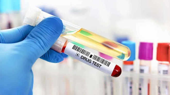 تحاليل المخدرات غير مطلوبة حاليا في ملفات التوظيف