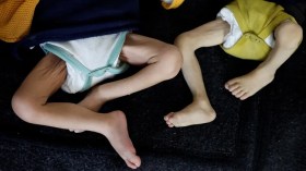 مأساة التجويع بغزة تكشف الوجه القبيح للمنظومة الدولية