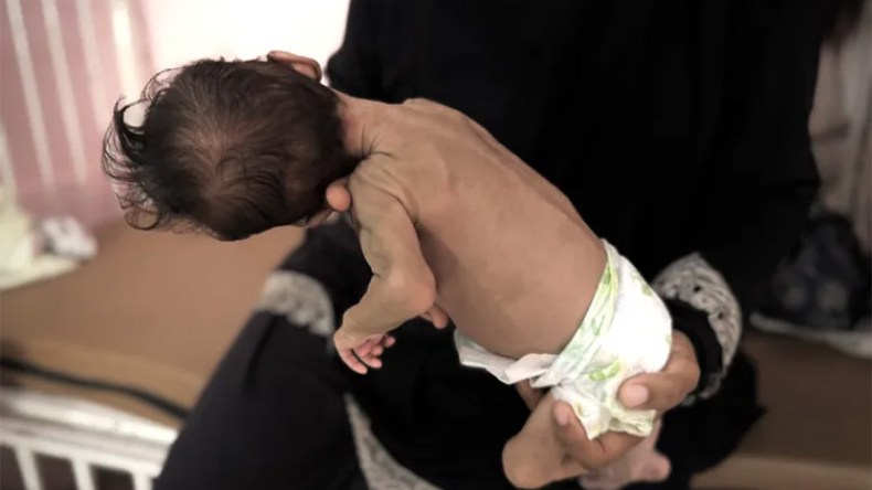 الاحتلال انتقل من سياسة التجويع إلى هندسة “المجاعة”