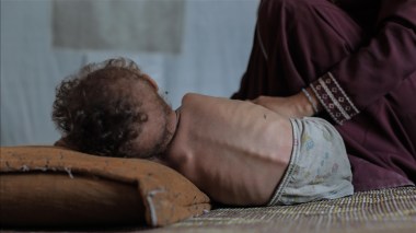 Gaza : 148 Palestiniens morts de malnutrition en raison du blocus israélien de l’aide, selon l’OMS