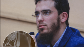 بالفيديو.. دكتور مغربي يبتكر جهازا ثوريا لتصفية الدم داخل الأوعية الدموية