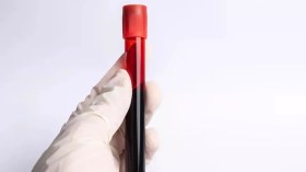 اكتشاف فصيلة دم نادرة لدى امرأة هندية