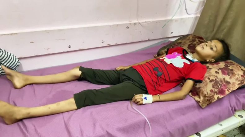 متلازمة “غيلان باريه”.. مرض نادر ينتشر بين أطفال غزة