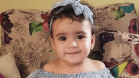 صورة متداولة على أنها للطفلة التي نهشتها الكلاب الضالة بالمسيلة.. هذه قصتها!