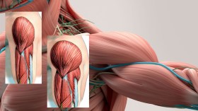 معاناة صامتة لمرضى الضمور العضلي في الجزائر!