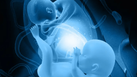 حالة طبية نادرة.. سيدة مصرية حامل بتسعة أجنة!