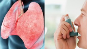 انتشار مخيف لأمراض الحساسية والربو وسط الجزائريين