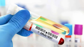 لا توظيف بدون شهادة عدم تعاطي المخدرات.. وهذا مصير أصحاب التحاليل الإيجابية