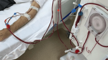 تحديات للتقليل من أمراض القلب والفشل الكلوي بالجزائر