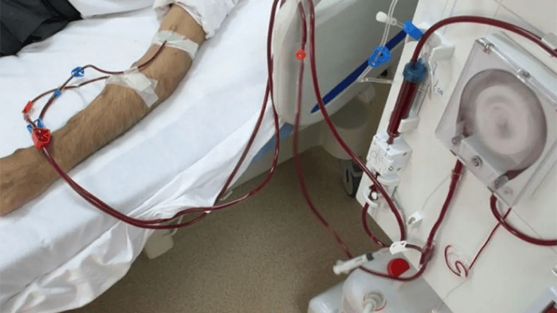 تحديات للتقليل من أمراض القلب والفشل الكلوي بالجزائر