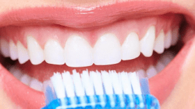 تعرّف على 7 طرق طبيعية لتبييض الأسنان