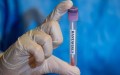 France: Un premier cas d’hantavirus confirmé après le rapatriement de passagers du MV Hondius