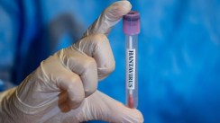France: Un premier cas d’hantavirus confirmé après le rapatriement de passagers du MV Hondius