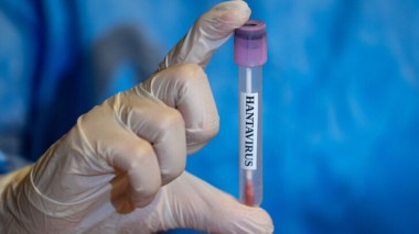 France: Un premier cas d’hantavirus confirmé après le rapatriement de passagers du MV Hondius