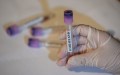 Les États-Unis placent l’épidémie de hantavirus au niveau d’alerte 3
