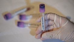 Les États-Unis placent l’épidémie de hantavirus au niveau d’alerte 3