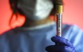 RDC: Une attaque contre un centre Ebola fait disparaître 13 patients suspects