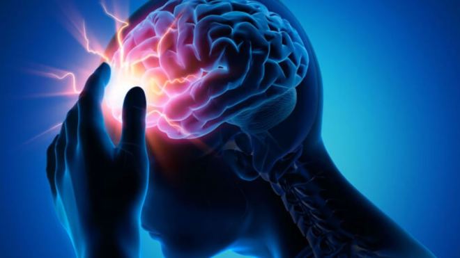السّكتة الدماغية… تحدّ صحّي متصاعد يستدعي سرعة التدخل وتعزيز الوقاية