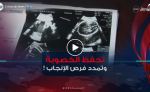 تجميد البويضات .. أمل جديد لحفظ الخصوبة وتمديد فرص الإنجاب