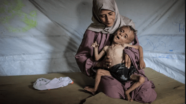 466 وفاة جراء سوء التغذية منذ 2024 في غزة