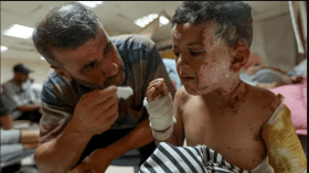 قيود الاحتلال توقف إنتاج أقنعة علاج الحروق في غزة