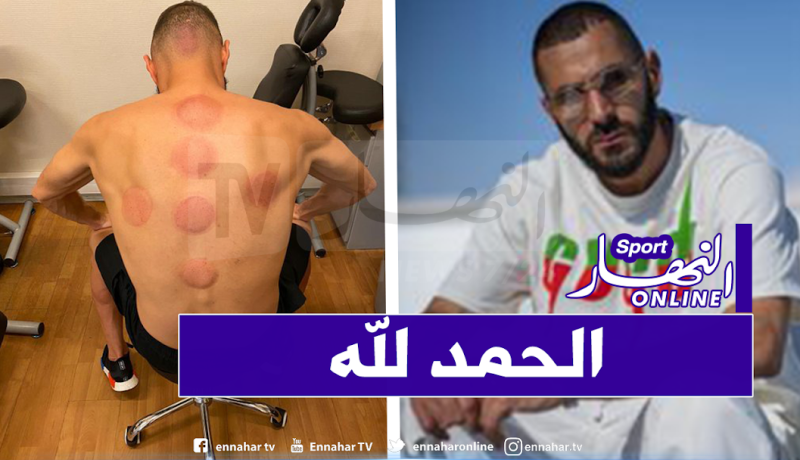 “الحجامة” سلاح بن زيمة قبل مواجهة ألافيس