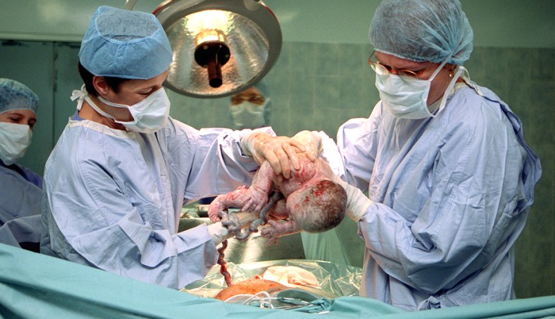 عام حبسا و40 مليونا غرامة لأطباء الإجهاض بالعيادات الخاصة