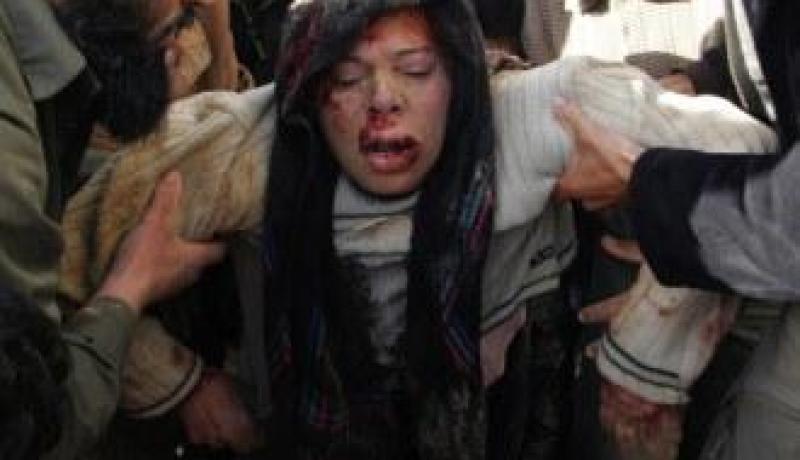 عملية “الرصاص المسكوب” ترفع حصيلتها الى 300 شهيد وألف جريح