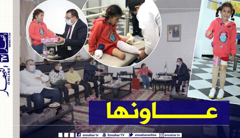 لفتة إنسانية من وزير العمل.. تجهيز الطفلة “رزقة” بأعضاء اصطناعية حديثة