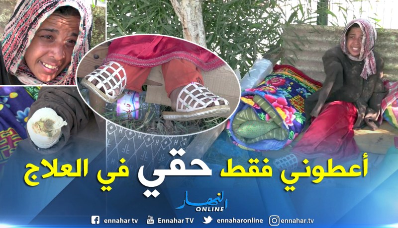 بالفيديو.. “بدرة” قصة أليمة لفتاة تبتر يداها تعفنا في شوارع وهران