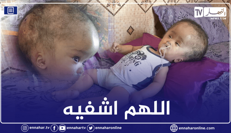المغير: البراءة عبد الله سنة من المعاناة يناشد السلطات بالتكفل الصحي