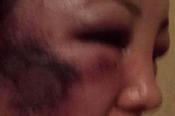 تيزي وزو : شاب يشوّه وجه شقيقته المحامية ويتسبب لها في جروح خطيرة