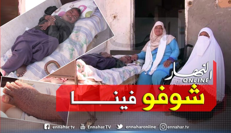 غرداية: معوقان.. احدهما لم يستحم منذ سنوات واخته تعاني نقص الدواء يستنجدان بالوالي 