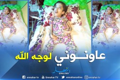بالصور .. عائلة الطفلة إكرام تناشد المحسنين التكفل بابنتهم المعاقة
