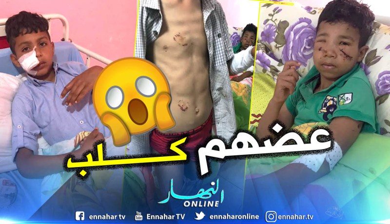 بالصور.. كلب مسعور يهاجم 3 اطفال ويدخلهم المستشفى بوهران