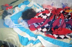 الوادي : مصلحة الأمراض المعدية تستقبل الأطفال المصابين بالبوحمرون