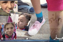 بالفيديو والصور.. إنتشار مرض الليشمانيوز وسط السكان وخاصة الأطفال في الوادي