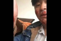 قرد ينتقم من سائح ويشوه وجهه