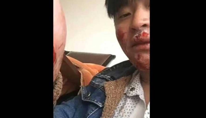 قرد ينتقم من سائح ويشوه وجهه