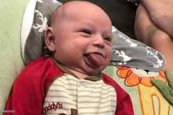 حالة طبية نادرة في أمريكا.. لسان رضيع ينمو بلا توقف