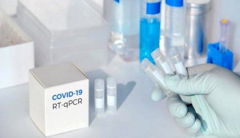 غليزان: اقتناء18250 وحدة كشف سريع لكورونا