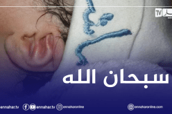 خنشلة: ولادة طفلة تحمل شكل لفظ الجلالة في كلتا أذنيها