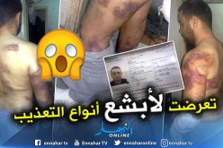 بالفيديو والصور.. حراڨ يروي تفاصيل خطفه وتعذيبه باليونان ويناشد السلطات بالتدخل