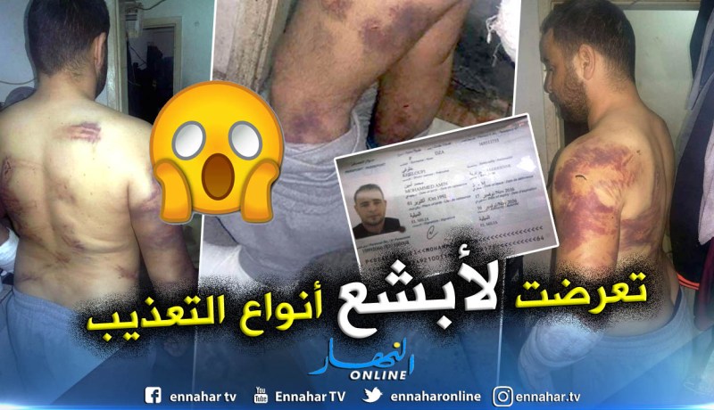 بالفيديو والصور.. حراڨ يروي تفاصيل خطفه وتعذيبه باليونان ويناشد السلطات بالتدخل