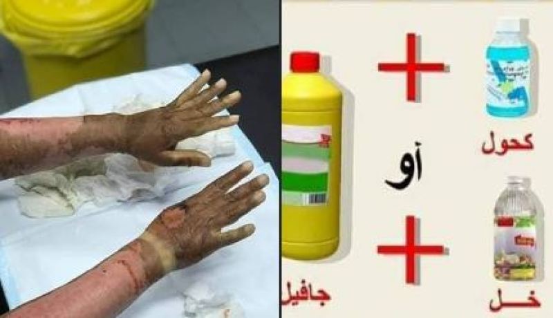 يتسبب استخدامها بحروق بليغة.. الحماية المدنية تحذر من المعقمات المنزلية