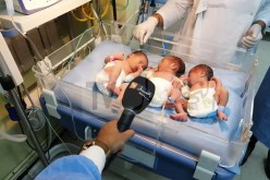 ولادة ثلاثة توائم بالمؤسسة الاستشفائية للنساء بسيدي بلعباس