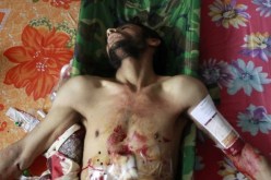 52 قتيلا في الهجوم على المتظاهرين في صنعاء