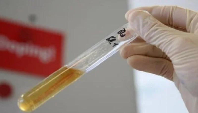 إخضاع  كل المباريات لمراقبة تناول المنشطات ابتداء من الجولة القادمة