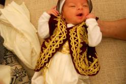 بعض الاطباء الجراحين يرفضون ختان الاطفال المصابين بالهيموفيليا