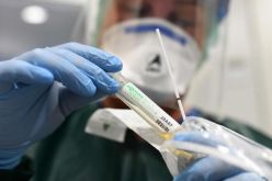 علماء الهند يبتكرون اختبارا جديدا لاكتشاف كورونا بـ”الماء المالح”